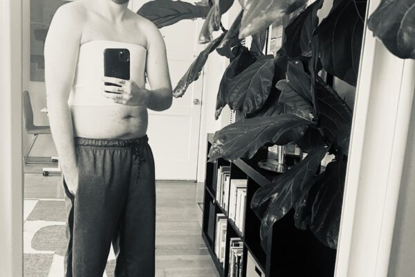 Dylan Thomas Cotter After Top Surgery